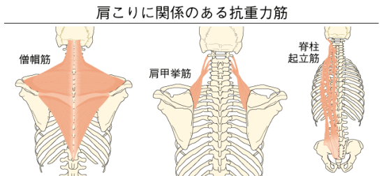 neck-tension-symptom03