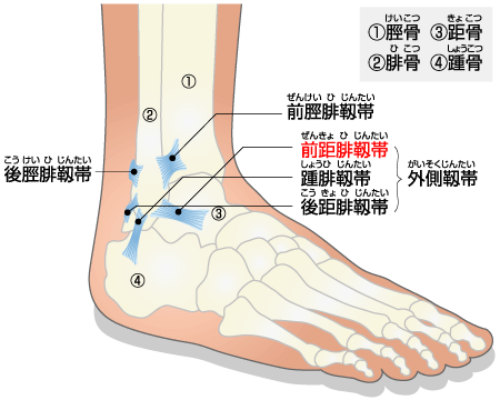 sprain_of_ankle.html