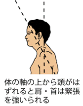 neck-tension-toothache-02