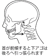 neck-tension-toothache-03